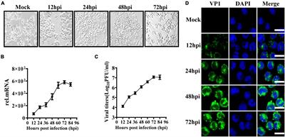 Enterovirus 71 Antagonizes Antiviral Effects of Type III Interferon and Evades the Clearance of Intestinal Intraepithelial Lymphocytes